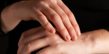 Alternative Diagnoses: Commonly Confused with Carpal Tunnel Syndrome