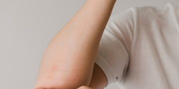 Alternative Diagnoses: Commonly Confused with Carpal Tunnel Syndrome