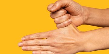 “Commonly Confused Conditions with Carpal Tunnel Syndrome”