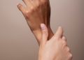 Two Conditions Commonly Confused with Carpal Tunnel Syndrome